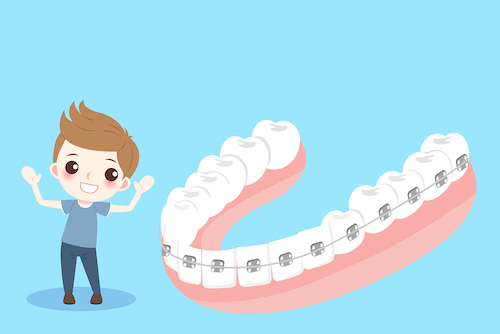 충치가 아니어도 이가 시리고 아플 수 있다? 치아경조직의 기타 질환!관련 썸네일 이미지